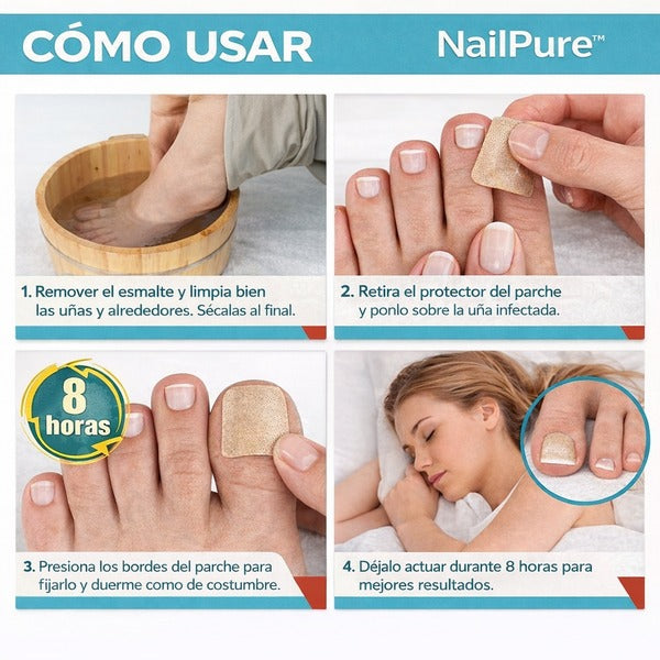NailPure™ | 2 Cajas de 16 Parches Antihongos para Uñas | Llévate 2x1