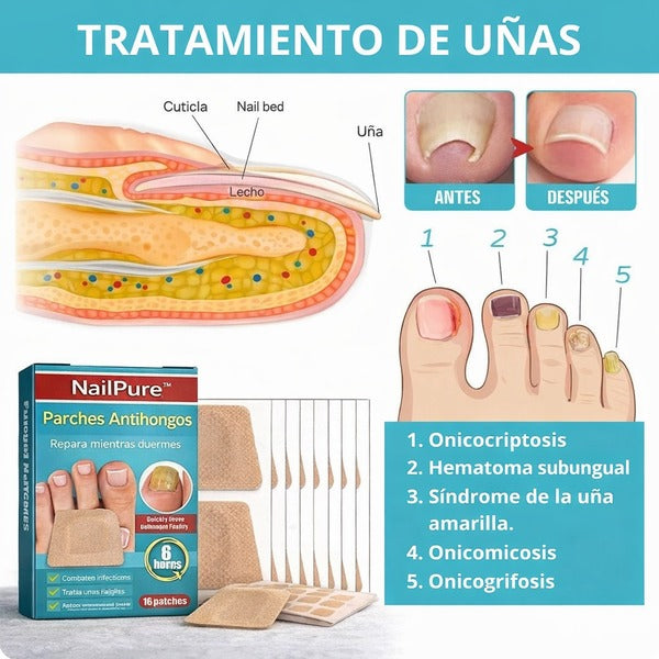 NailPure™ | 2 Cajas con 16 Parches c/u Antihongos para Uñas | Llévate 2x1